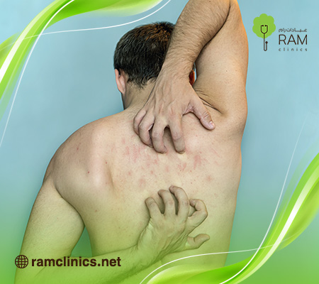 اسباب-حكة-الجلد