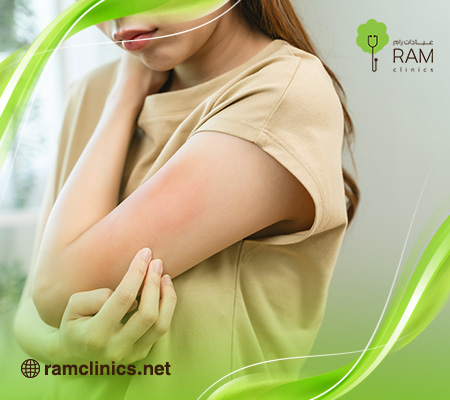 أسباب-حكة-الجسم-المفاجئة