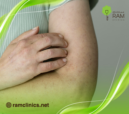 أسباب-حكة-الجسم-المستمرة