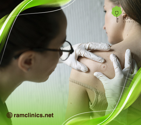 هذلول-الجلد