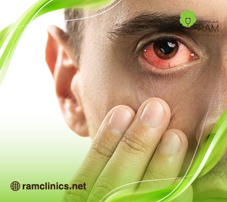 سبب-العيون-الحمراء