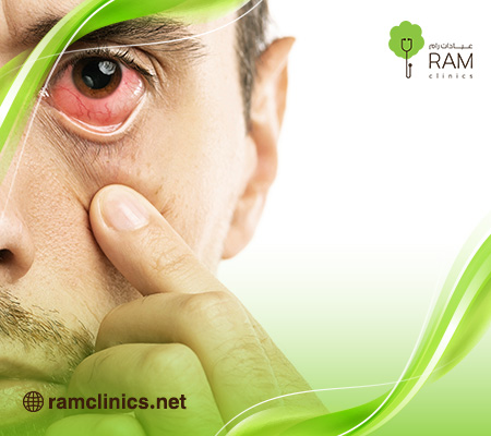 سبب-احمرار-العين