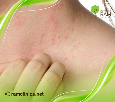 علاج-الحكة-في-الجسم