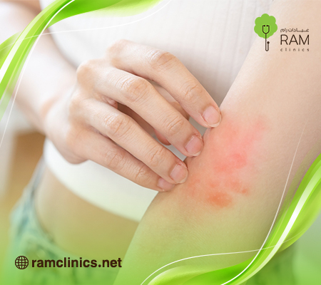 ماسبب-الحكه-في-الجسم