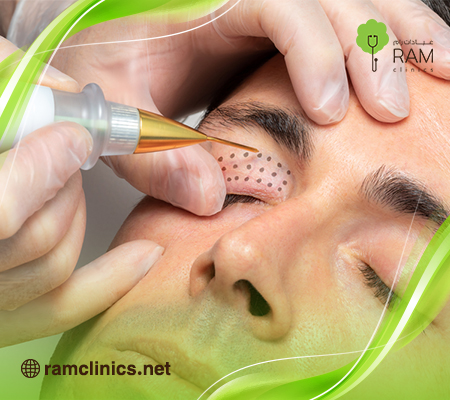 عملية-شد-الجفن