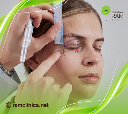 كم-تكلفة-عملية-شد-الجفون-في-السعودية