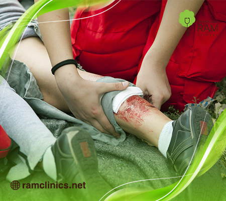 الاسعافات-الأولية-للحروق