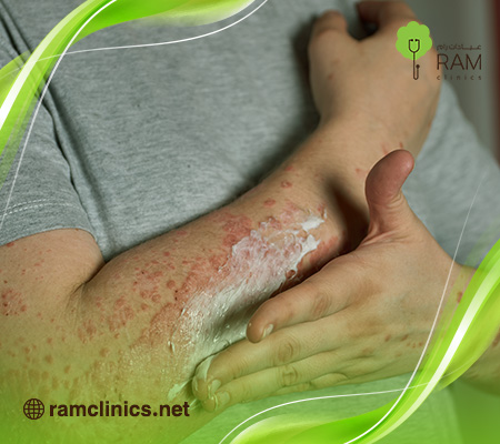 هل-مرض-الزهري-خطير