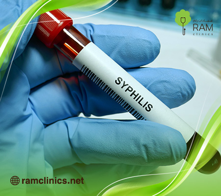 ماهو-الزهري