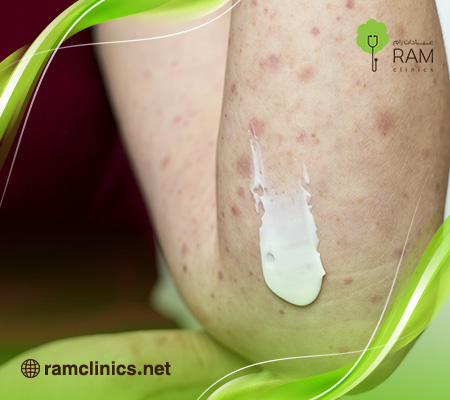 علاج-الحبوب-الحمراء-في-الجسم