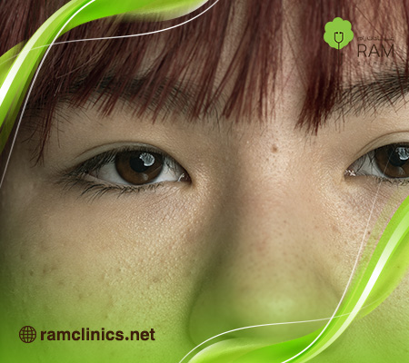 ظهور-حبوب-في-الجسم-فجأة