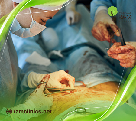 اعراض-التهاب-العملية-القيصرية