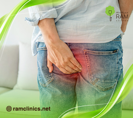 اعراض-البواسير-الخارجية