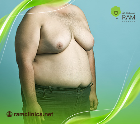 علاج-التثدي-عند-الرجال