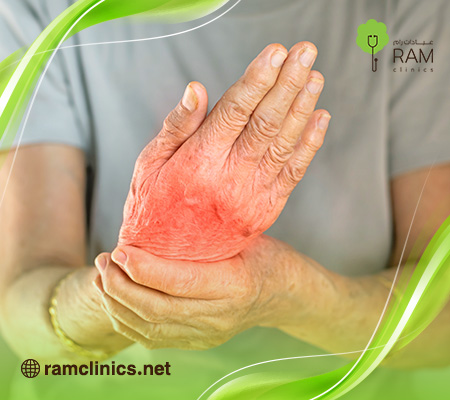 علاج-تنميل-اليدين