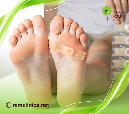 مسمار-القدم 