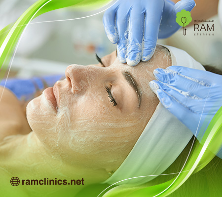 التقشير-البارد-للوجه