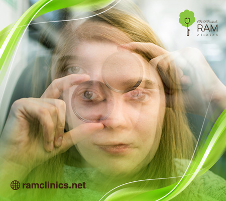 ماهي-زغللة-العين