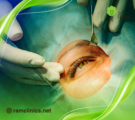 علاج-خدش-القرنية