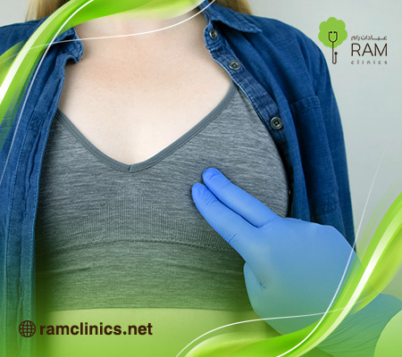 اعراض-الكيس-الدهني-في-الثدي