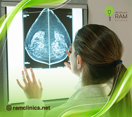 الكيس-الدهني-في-الثدي