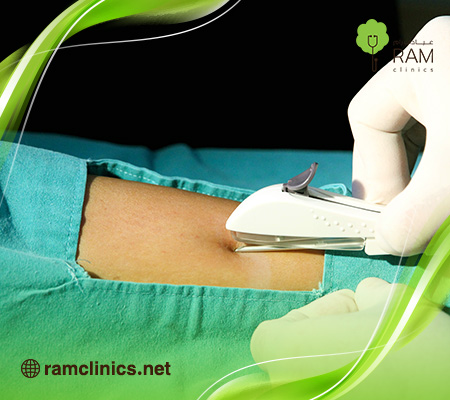 الأعراض-بعد-إزالة-شريحة-منع-الحمل