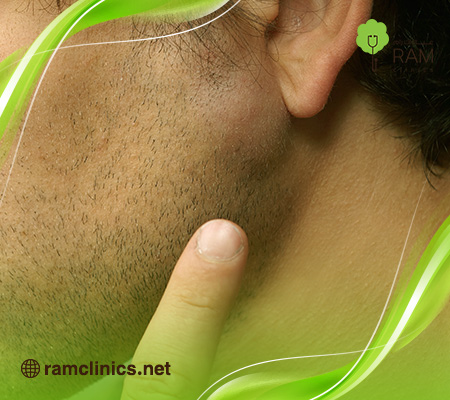 تجربتي-مع-الورم-الشحمي