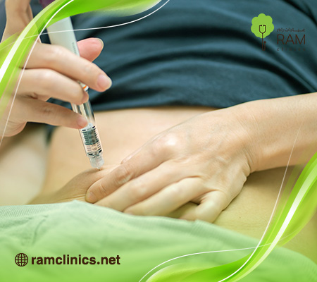 طرق-تنشيط-المبايض