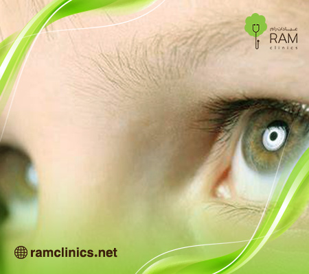 اسباب-رأرأة-العين