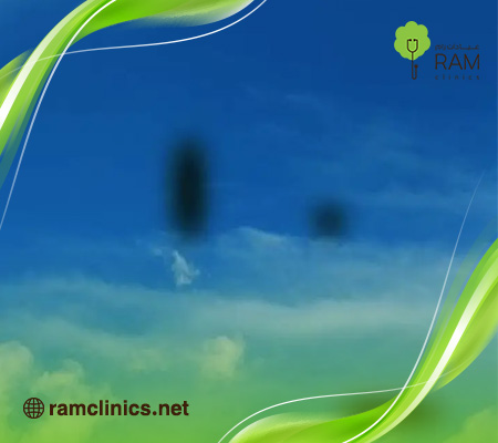 ما-هي-ذبابة-العين