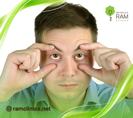 هل-ذبابة-العين-خطيرة