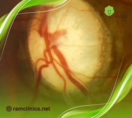 اسباب-الضمور-البصري