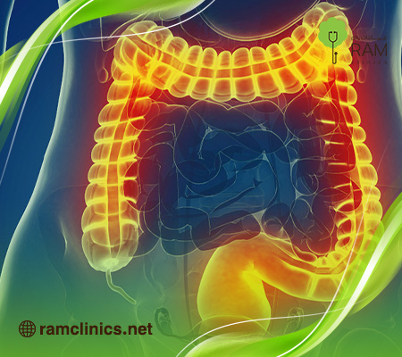 علاج-القولون-العصبي-النفسي