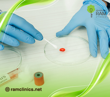 ارتفاع-تحليل-rbc