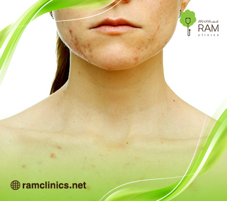 انواع-الحبوب-في-الجسم