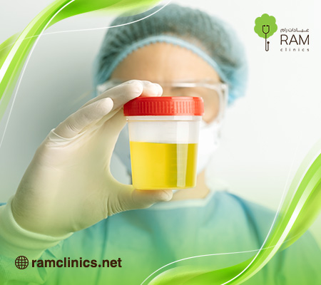 لون-البول-غامق-مثل-الشاي