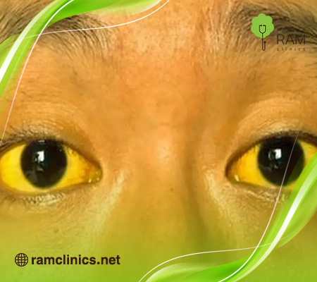 ماهو-ابو-صفار