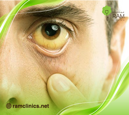 اعراض-ابو-صفار-عند-الكبار