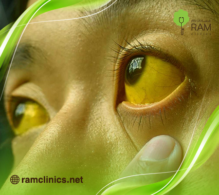 هل-مرض-الصفراء-خطير-للكبار