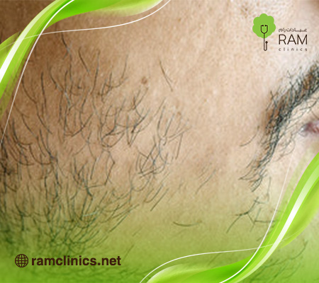 زراعة-الشنب-واللحية-في-السعودية