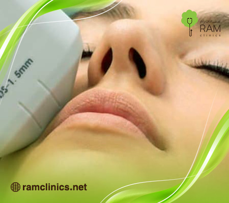 الهايفو-للوجه-قبل-وبعد