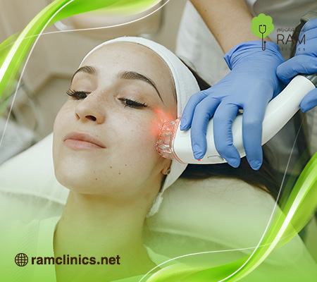 تجربتي-في-علاج-البهاق-بالليزر