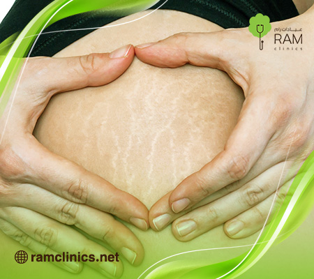 سبب-تشققات-الجسم-الحمراء