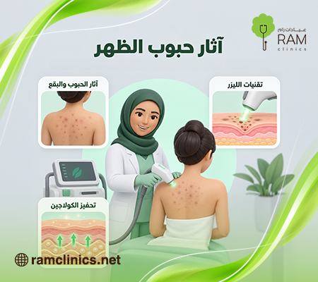 علاج حبوب الظهر بعد الليزر