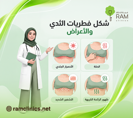 إنفوجرافيك يوضح أعراض الفطريات الجلدية تحت الثدي مثل الأحمرار والحكة والتسلخات.