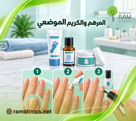 أفضل كريم لعلاج فطريات الأظافر
