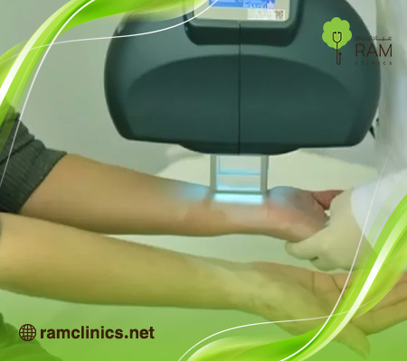 سعر-جهاز-الأشعة-فوق-البنفسجية-لعلاج-البهاق