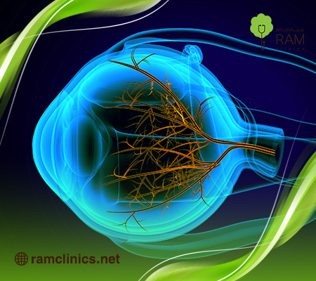 حالات-شفيت-من-ضمور-العصب-البصري