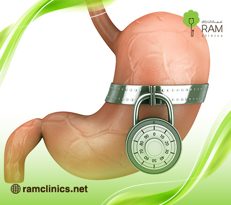 توسع-المعده-بعد-التكميم