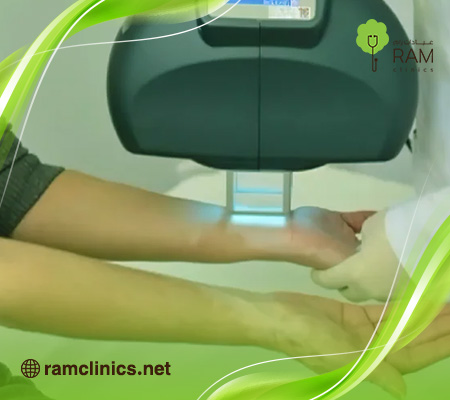 علاج-البهاق-بالليزر